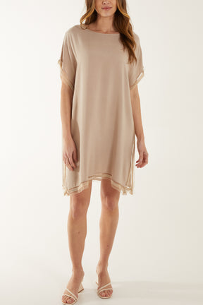 Embellished Hem Tunic Dress