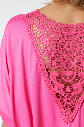 Medallion Lace Back Loose Top
