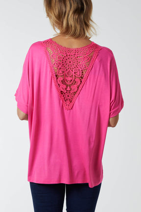 Medallion Lace Back Loose Top